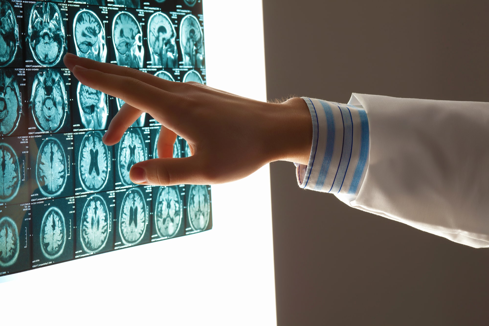brain injury lawyer Indianapolis, IN